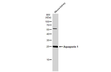 Anti-Aquaporin 1 antibody used in Western Blot (WB). GTX132870