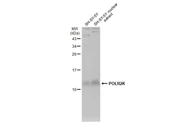 Anti-POLR2K antibody used in Western Blot (WB). GTX132872
