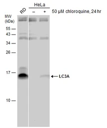 Anti-LC3A antibody used in Western Blot (WB). GTX132889