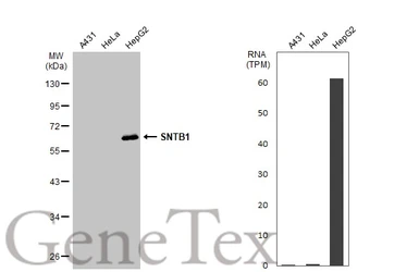 Anti-SNTB1 antibody used in Western Blot (WB). GTX132898