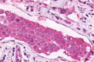 Anti-XPR1 antibody used in IHC (Paraffin sections) (IHC-P). GTX13290