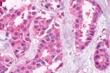 Anti-XPR1 antibody used in IHC (Paraffin sections) (IHC-P). GTX13290