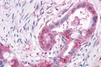 Anti-XPR1 antibody used in IHC (Paraffin sections) (IHC-P). GTX13290
