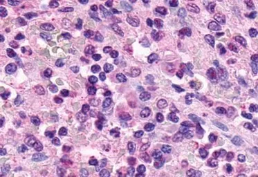 Anti-XPR1 antibody used in IHC (Paraffin sections) (IHC-P). GTX13290