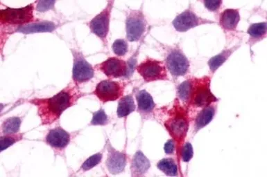Anti-XPR1 antibody used in Immunocytochemistry/ Immunofluorescence (ICC/IF). GTX13290