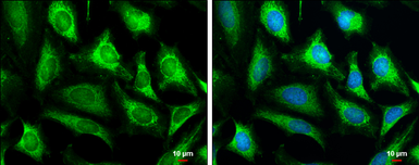 Anti-COX4I2 antibody used in Immunocytochemistry/ Immunofluorescence (ICC/IF). GTX132905