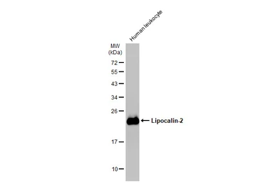 Anti-Lipocalin-2 antibody used in Western Blot (WB). GTX132906