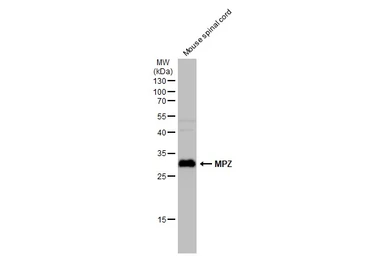 Anti-MPZ antibody used in Western Blot (WB). GTX132911