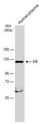 Anti-C6 antibody used in Western Blot (WB). GTX132919