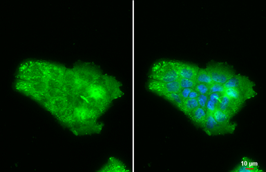 Anti-Lipocalin-2 antibody used in Immunocytochemistry/ Immunofluorescence (ICC/IF). GTX132936