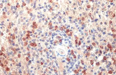 Anti-Lipocalin-2 antibody used in IHC (Paraffin sections) (IHC-P). GTX132936