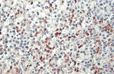 Anti-Lipocalin-2 antibody used in IHC (Paraffin sections) (IHC-P). GTX132952