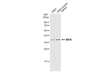 Anti-NIFK antibody used in Western Blot (WB). GTX132955