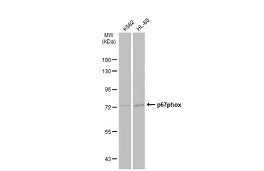 Anti-p67phox antibody used in Western Blot (WB). GTX132967