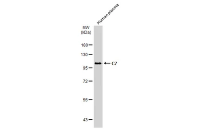 Anti-C7 antibody used in Western Blot (WB). GTX132977