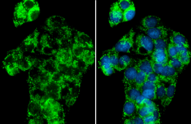 Anti-NDUFA9 antibody used in Immunocytochemistry/ Immunofluorescence (ICC/IF). GTX132978
