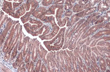 Anti-NDUFA9 antibody used in IHC (Paraffin sections) (IHC-P). GTX132978