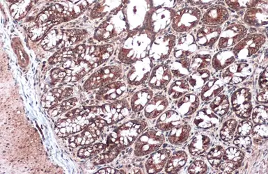 Anti-NDUFA9 antibody used in IHC (Paraffin sections) (IHC-P). GTX132978