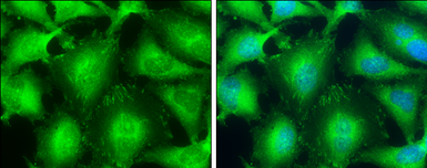 Anti-VASP antibody used in Immunocytochemistry/ Immunofluorescence (ICC/IF). GTX132983