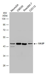 Anti-VASP antibody used in Western Blot (WB). GTX132983