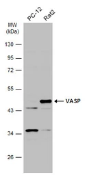 Anti-VASP antibody used in Western Blot (WB). GTX132983