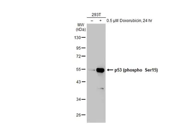 Anti-p53 (phospho Ser15) antibody used in Western Blot (WB). GTX132995