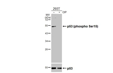 Anti-p53 (phospho Ser15) antibody used in Western Blot (WB). GTX132995