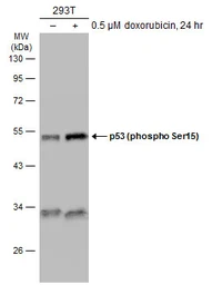 Anti-p53 (phospho Ser46) antibody used in Western Blot (WB). GTX132996