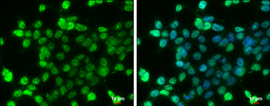 Anti-p53 (phospho Ser46) antibody used in Immunocytochemistry/ Immunofluorescence (ICC/IF). GTX132996