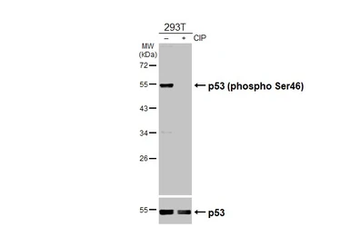 Anti-p53 (phospho Ser46) antibody used in Western Blot (WB). GTX132996