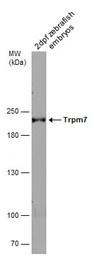 Anti-Trpm7 antibody used in Western Blot (WB). GTX133007