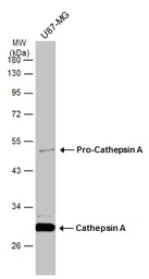 Anti-Cathepsin A antibody used in Western Blot (WB). GTX133016