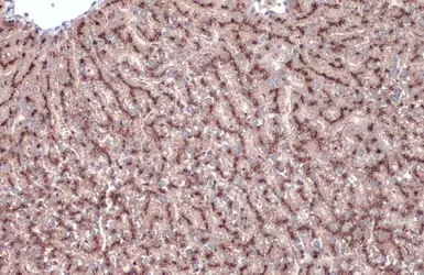 Anti-Cathepsin A antibody used in IHC (Paraffin sections) (IHC-P). GTX133016