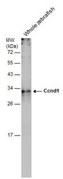 Anti-Ccnd1 antibody used in Western Blot (WB). GTX133053