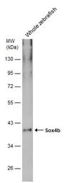 Anti-Sox4b antibody used in Western Blot (WB). GTX133068