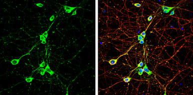 Anti-CaMKII alpha antibody used in Immunocytochemistry/ Immunofluorescence (ICC/IF). GTX133071