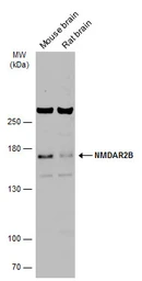 Anti-NMDAR2B antibody used in Western Blot (WB). GTX133099