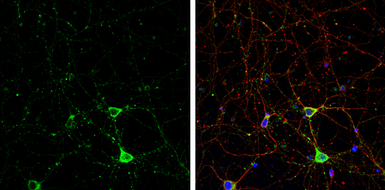 Anti-IP3 Receptor I antibody used in Immunocytochemistry/ Immunofluorescence (ICC/IF). GTX133104