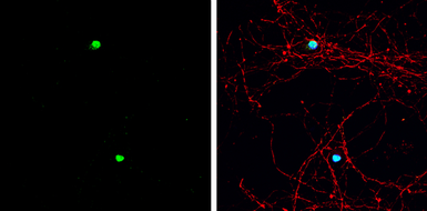 Anti-ASCL1 antibody used in Immunocytochemistry/ Immunofluorescence (ICC/IF). GTX133105