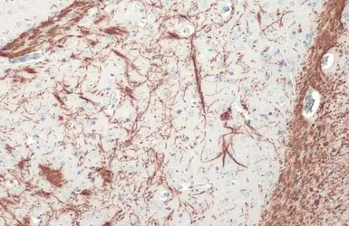 Anti-Myelin basic protein antibody used in IHC (Paraffin sections) (IHC-P). GTX133108