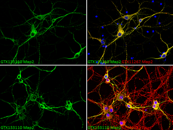 Anti-MAP2 antibody used in Immunocytochemistry/ Immunofluorescence (ICC/IF). GTX133110