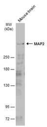 Anti-MAP2 antibody used in Western Blot (WB). GTX133110