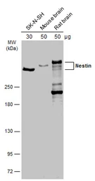 Anti-Nestin antibody used in Western Blot (WB). GTX133111