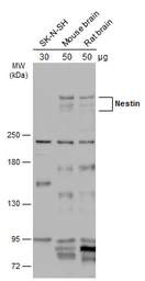 Anti-Nestin antibody used in Western Blot (WB). GTX133112