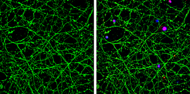 Anti-Nestin antibody used in Immunocytochemistry/ Immunofluorescence (ICC/IF). GTX133112