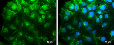 Anti-Nestin antibody used in Immunocytochemistry/ Immunofluorescence (ICC/IF). GTX133112