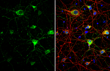 Anti-Somatostatin antibody used in Immunocytochemistry/ Immunofluorescence (ICC/IF). GTX133119