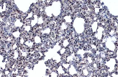 Anti-NKX2.1 antibody used in IHC (Paraffin sections) (IHC-P). GTX133121