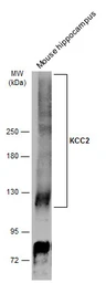 Anti-KCC2 antibody used in Western Blot (WB). GTX133130