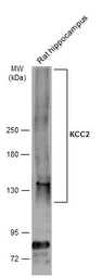 Anti-KCC2 antibody used in Western Blot (WB). GTX133130